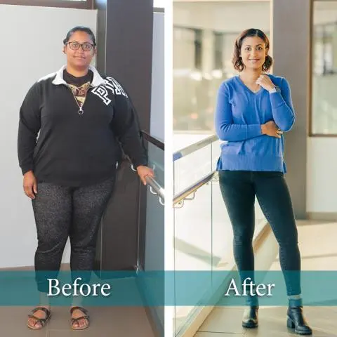 Barsha-Weight-loss-Before-After